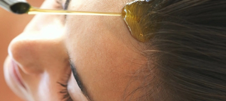 scalp psoriasis treatment 