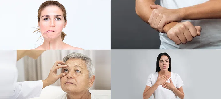 Stroke Rehabilitation Programs