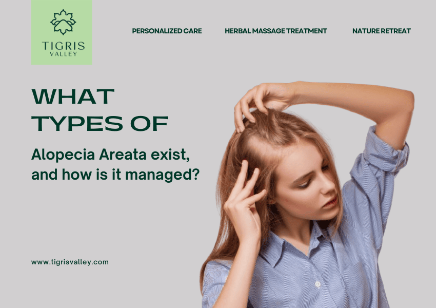 How to Treat alopecia