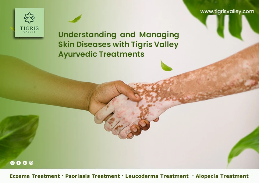 skin diseases treatment