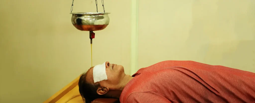 Ayurvedic shirodhara treatment