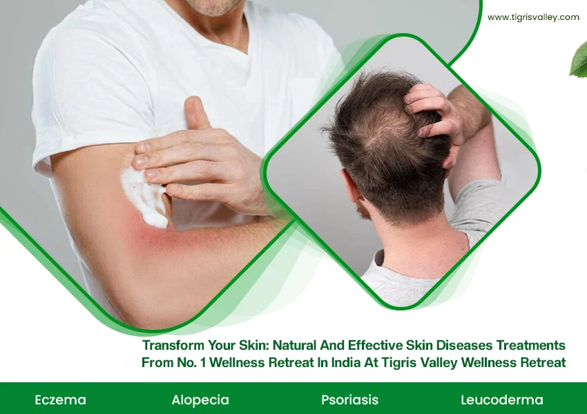 Effective Skin Diseases Treatments From No. 1 Wellness Retreat in India